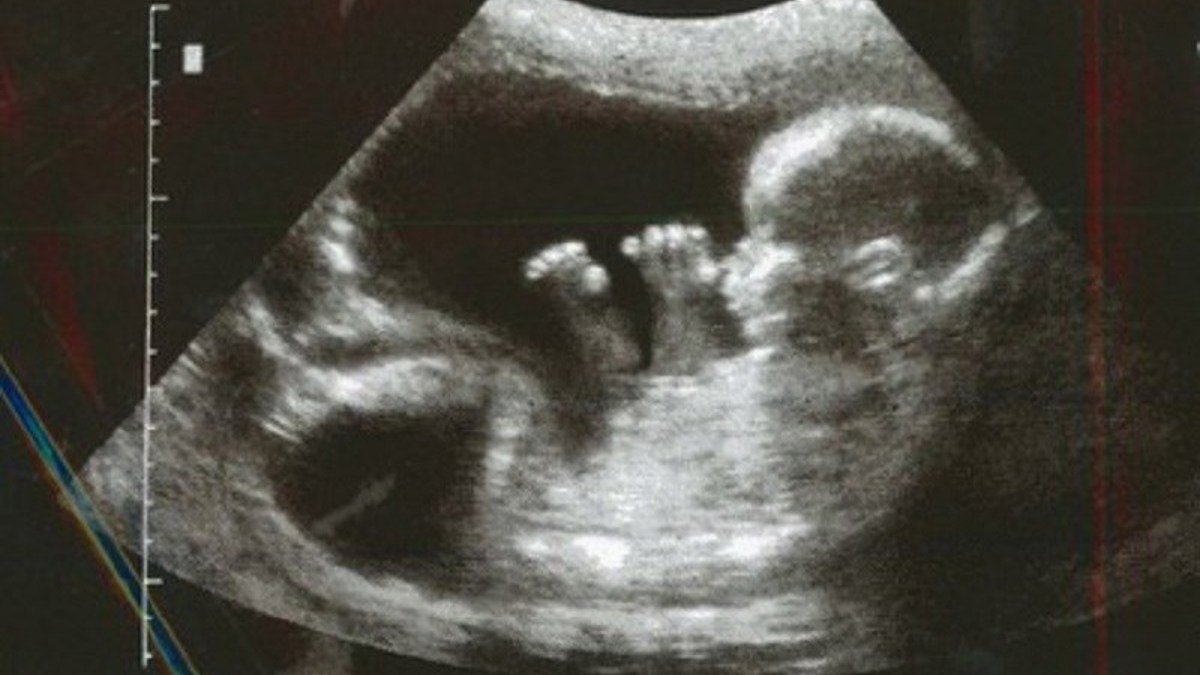 Voters can prevent Abortion Control Act's cancellation - Vimarsana News